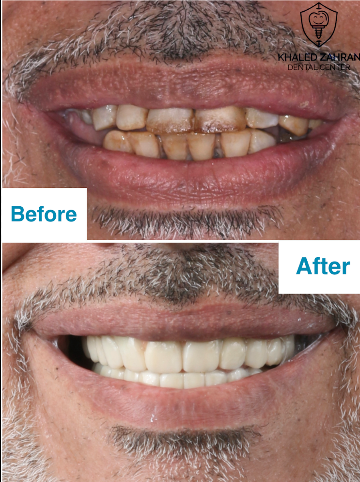 حالة علاج وتجميل الأسنان